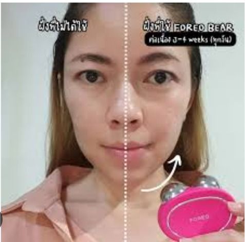 FOREO BEAR Smart Microcurrent Facial Toning Device (Category: Face Care) located in San Fernando. Submitted by kayr_ (Listing ID 1442787445, Image 3). Description: - FOREO BEAR smart microcurrent facial toning device - Lifts and tones skin for a firmer, more youthful appearance - "None of the pain, all of the gain" - effective results without discomfort - Ideal for at-home skincare routines - Includes original clear protective case -Helps to slim