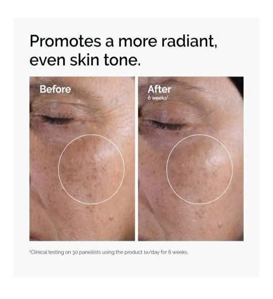 The Ordinary Glycholic Acid 7% 100ml (Category: Face Care) located in Quezon City. Submitted by barbosac (Listing ID 1449590415, Image 2). Description: ✨ The Ordinary Glycolic Acid 7% Exfoliating Toner (100ml) 995php - 100ml, 10 bits intransit 🔥 Eta: July 24 🇵🇭 ✅ 💯% Authentic from 🇺🇸 Achieve smoother, brighter, and more even-looking skin with The Ordinary Glycolic Acid 7% Exfoliating Toner. Formulated with 7% Glycolic Acid (AHA), it gently 