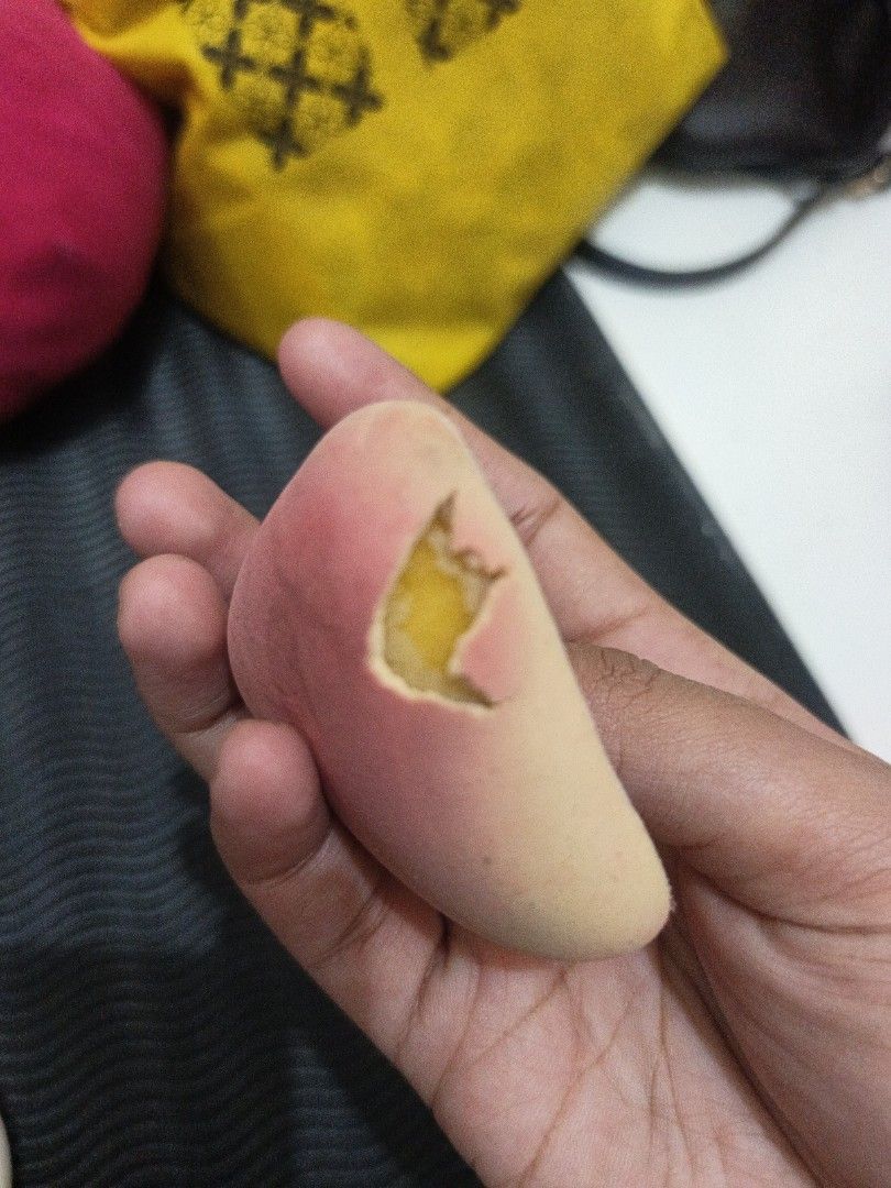 Aeris puff (Kategori: Kulit, Sabun & Tubuh) berada di Tangerang. Dikirim oleh naylaacrr (ID iklan 1449861395, Gambar 3). Deskripsi: kondisinya seperti di foto.