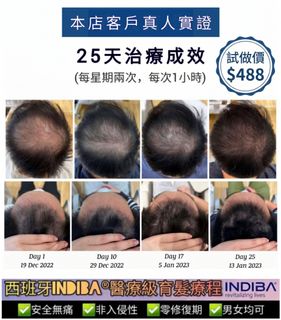 （分類：）位於 。 由 ming2587 提交（商品編號 1450017520，圖片 1）。簡介： 。