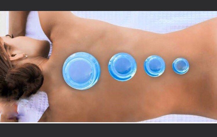Edge Body massager vacuum cupping cups (Category: Massage Devices) located in Marikina City. Submitted by theconstantdeclutterer (Listing ID 1452474041, Image 2). Description: New Edge 3 pcs plastic large medium small blue vacuum cupping cups. Use with oil to glide on your body as a massager and leave for improved blood circulation and pain healing. Get me now!.