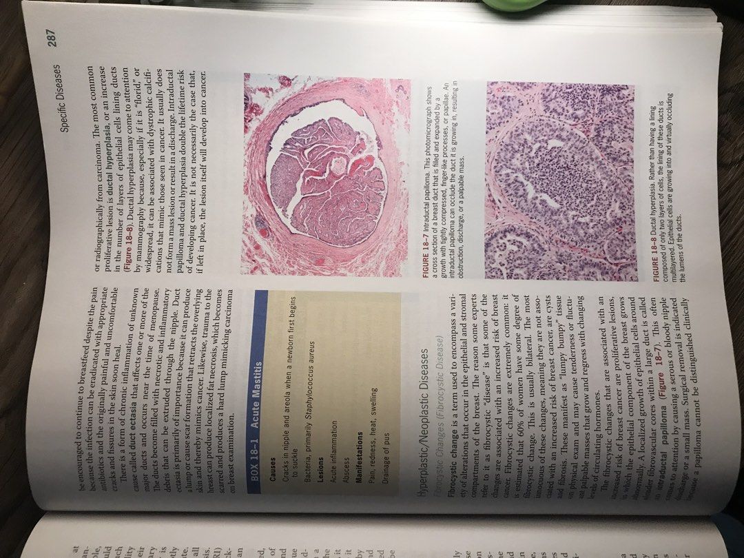 Introduction to Human Disease Pathophysiology 6th Edition (Category: Textbooks) located in Paranaque City. Submitted by mozza_1 (Listing ID 1456219779, Image 3). Description: BRAND NEW, never read. Book is super helpful and insightful for medical students and entrance exams. Photos are colored as well!! - Introduction to Human Disease Pathophysiology, Sixth Edition - Authors: Agnes G. Loeffler & Michael N. Hart - Includes online access code - Ide