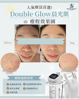 （分類：）位於 。 由 tak_enfriendly 提交（商品編號 1456453471，圖片 1）。簡介： 。
