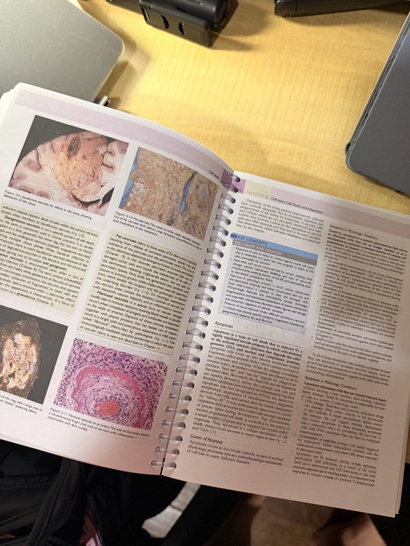 Pathologic Basis of Disease (Category: Textbooks) located in Quezon City. Submitted by mshpsmbxx (Listing ID 1457253958, Image 2). Description: - Bought in orange app - Booklet Type - 70 GSM - coil bind - orig price 1350 in orange app gcash bdo bpi lalamove or grab only .
