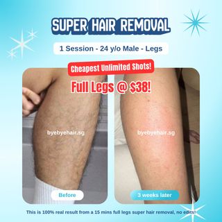 (Category: ) located in . Submitted by byebyehair.sg (Listing ID 1454363295, Image 1). Description: .