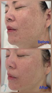 (Category: ) located in . Submitted by mlskinaesthetics (Listing ID 1454586408, Image 1). Description: .
