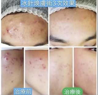 （分類：）位於 。 由 bingbinga 提交（商品編號 1460802751，圖片 1）。簡介： 。