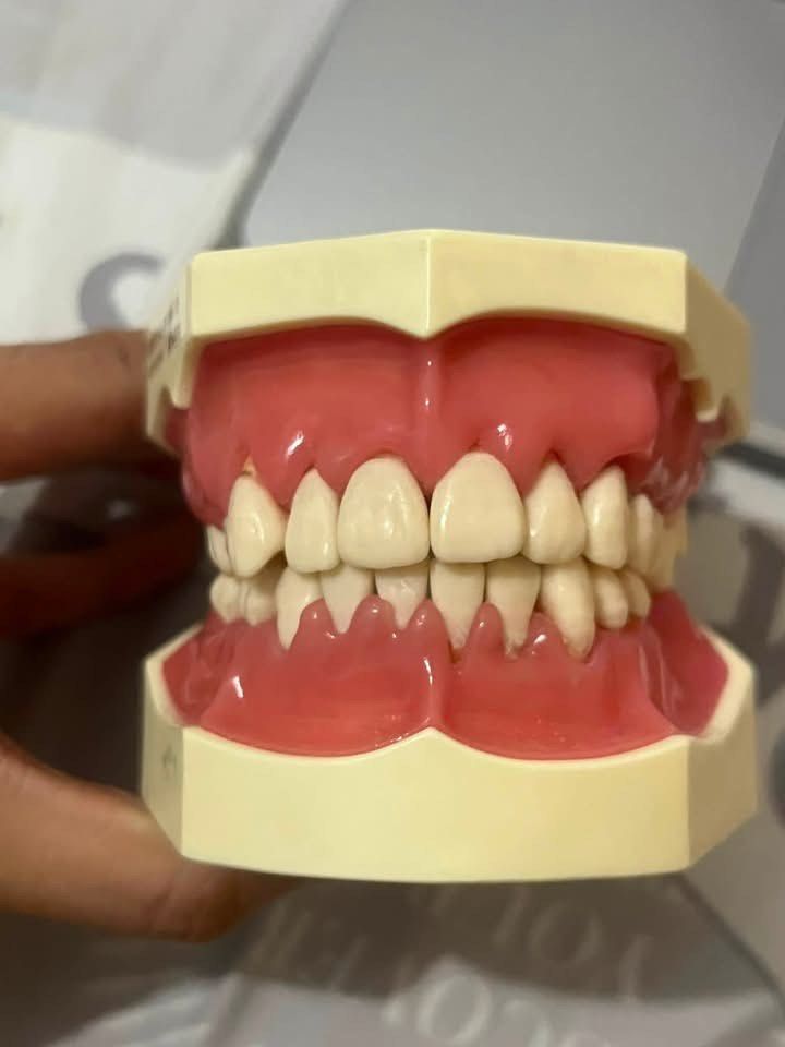 Nissin Perio Jaw (Category: Medical Supplies & Tools) located in Pasay City. Submitted by paulyndianne (Listing ID 1460820404, Image 1). Description: - has a small laceration on #33, pls see last pic.