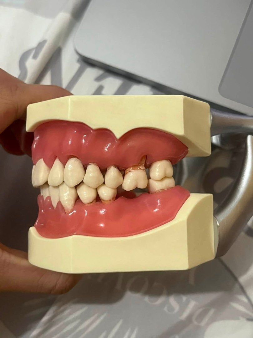 Nissin Perio Jaw (Category: Medical Supplies & Tools) located in Pasay City. Submitted by paulyndianne (Listing ID 1460820404, Image 3). Description: - has a small laceration on #33, pls see last pic.