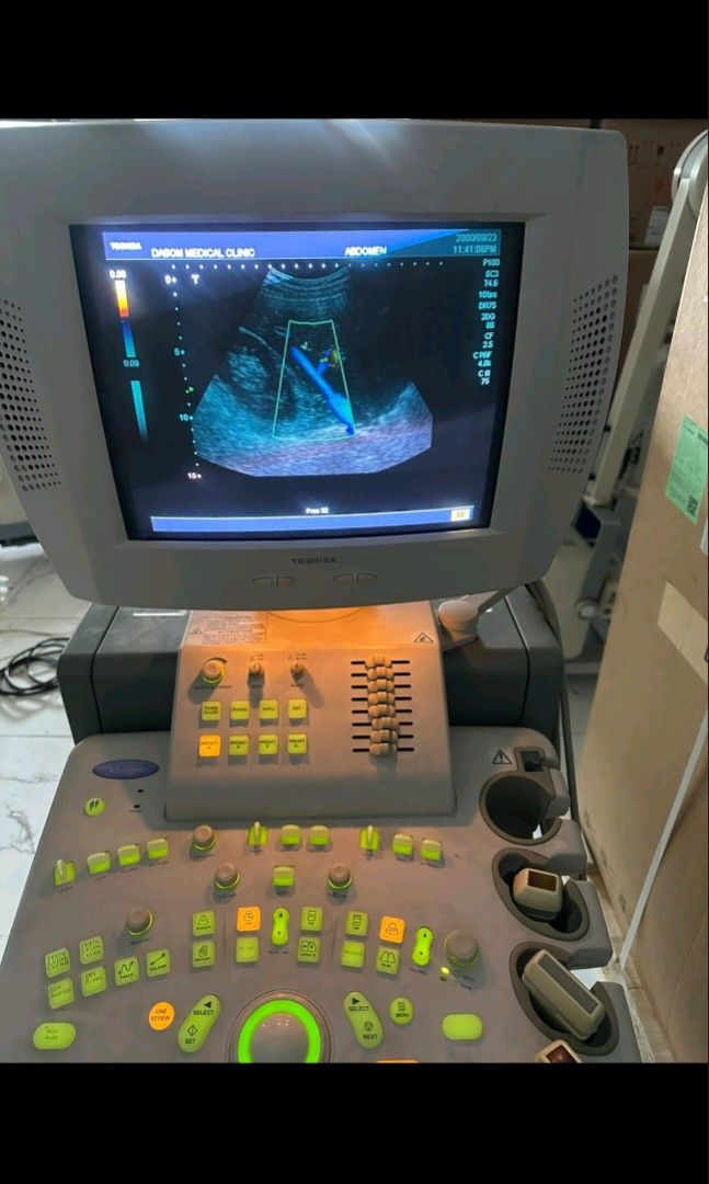 Ultrasound Machine (Category: Medical Supplies & Tools) located in Angeles City. Submitted by ryainramos (Listing ID 1462686017, Image 1). Description: Toshiba nemio 30 2D echo machine with 3probes With printer.
