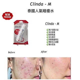 （分類：）位於 。 由 dezaz 提交（商品編號 1463183663，圖片 1）。簡介： 。