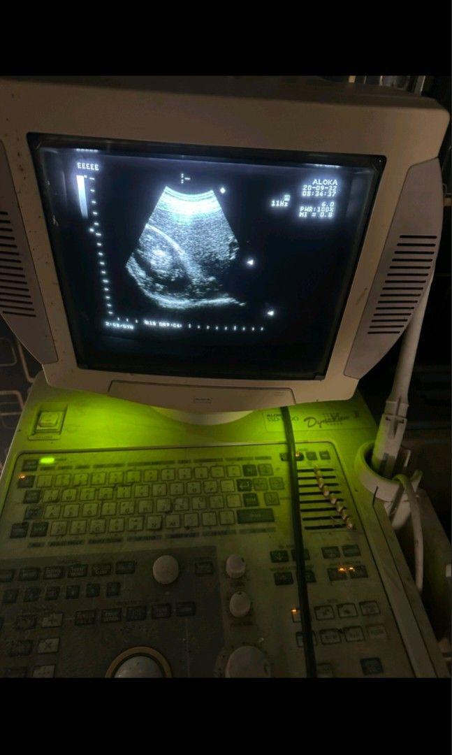 Ultrasound Machine (Category: Medical Supplies & Tools) located in Angeles City. Submitted by ryainramos (Listing ID 1463354894, Image 2). Description: Aloka ssd-1700 2 probes convex transvaginal.