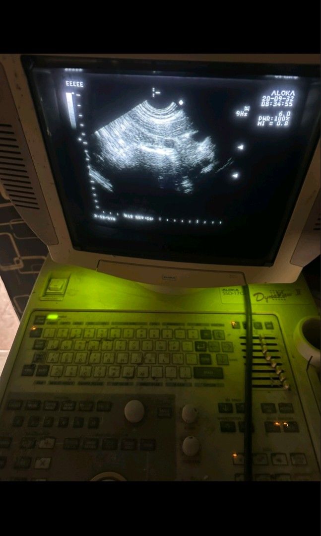 Ultrasound Machine (Category: Medical Supplies & Tools) located in Angeles City. Submitted by ryainramos (Listing ID 1463354894, Image 1). Description: Aloka ssd-1700 2 probes convex transvaginal.