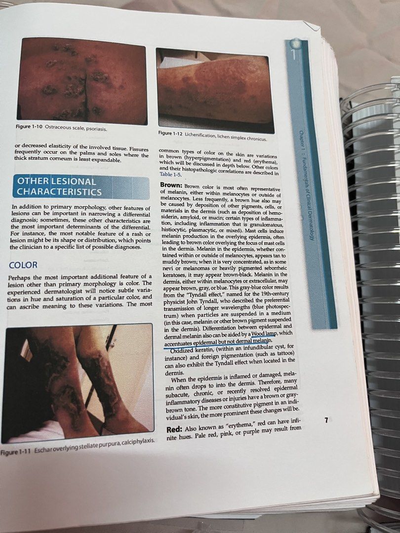 Fitzpatrick Dermatology, 9th Edition (Category: Everything Else Others) located in Manila. Submitted by fancyschmancynezz (Listing ID 1464174522, Image 2). Description: Fitzpatrick Dermatology, 9th Edition — FOR SALE Divided into 5 parts/volumes for easier handling and studying. • Resized to 8.5 × 6.5 inches • 80 GSM paper • Colored pages • Coil bound • With very minimal highlights and underlines 💰 ₱3,500 Original price: 5k Good condition and re