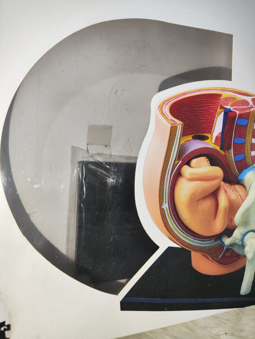 3D Anatomy Model Pregnancy Pelvis Graviditet (Category: Medical Supplies & Tools) located in Cavite. Submitted by tinetaclesss (Listing ID 1459427749, Image 3). Description: - 3D anatomical model of a pregnant pelvis. - Includes a fetus in utero. - Ideal for educational purposes. - All parts are intact and in original packaging. - Comes with a display base. - Suitable for students and anatomy enthusiasts..