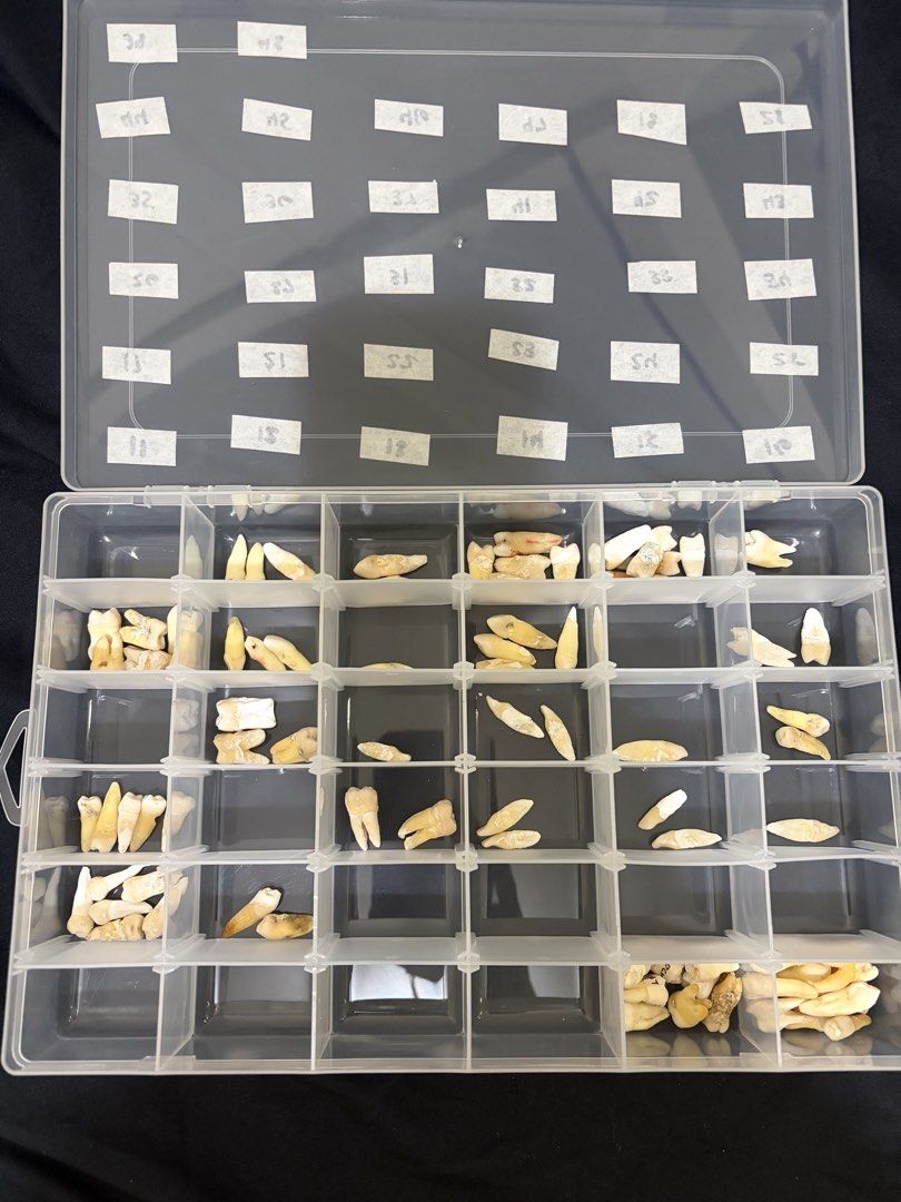 Natural Tooth Specimen (Category: Medical Supplies & Tools) located in San Pedro. Submitted by dainty00 (Listing ID 1464970384, Image 1). Description: 250 each natural tooth loc: binan laguna sf for j&t (1 day deli) - less than 60pesos pm if need specific tooth, restocking if need.