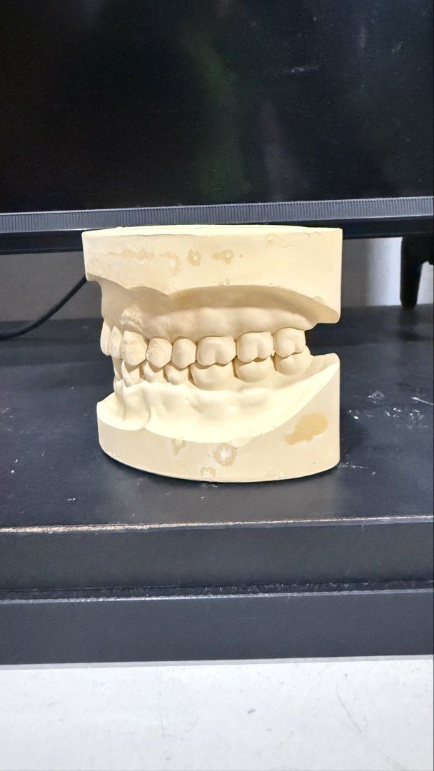 Dental Study Model - Upper and Lower Jaw Casts (Category: Medical Supplies & Tools) located in Quezon City. Submitted by thriftastoreph (Listing ID 1459945523, Image 1). Description: - Dental study model featuring upper and lower jaw casts. - Detailed teeth structure for educational purposes. - Made from durable plaster. - Ideal for dental students and educational institutions. 60 each / ung isa nay makings used for ortho appliance practical exam