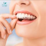 （分類：）位於 。 由 invisible.orthodontics 提交（商品編號 1380790173，圖片 1）。簡介： 。